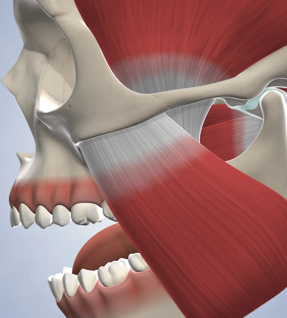 query  tmj